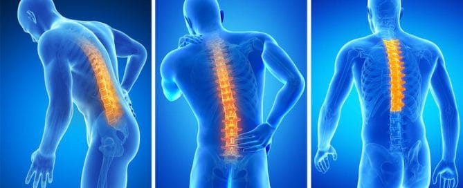 Lumbar Injection Therapy