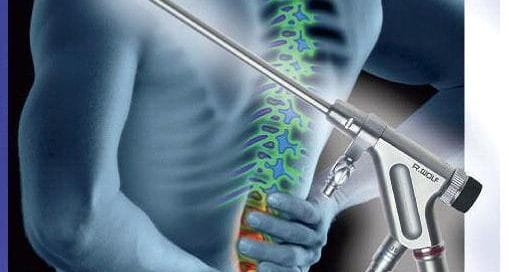 endoscopic