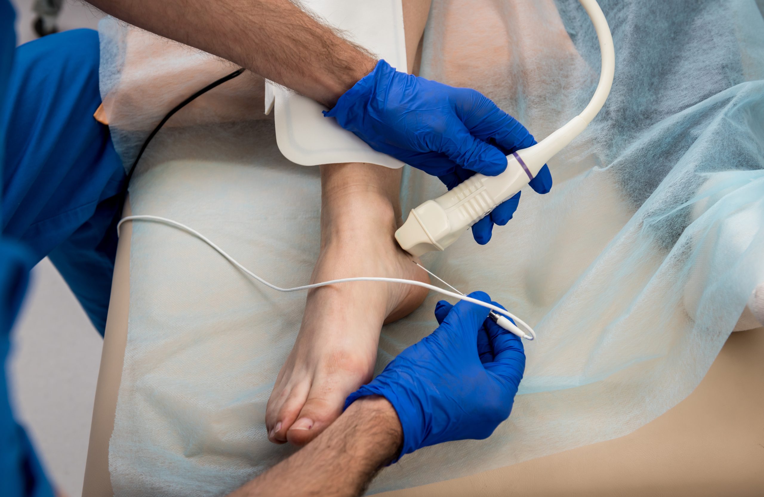 Cardiologist,Use,Tubes,And,Ultrasound,For,Radiofrequency,Catheter,Ablation. Cardiologist,Use,Tubes,And,Ultrasound,For,Radiofrequency,Catheter,Ablation.